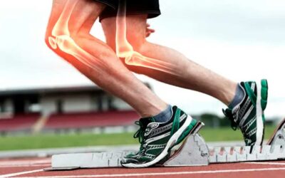 Rodillera con IA: La revolución en la prevención de lesiones deportivas en la rodilla